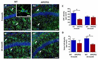 Accelerated Dystrophy and Decay of Oligodendrocyte Precursor Cells in the APP/PS1 Model of Alzheimer’s-Like Pathology